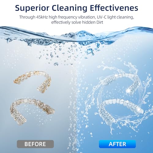 Ultrasonic Retainer Cleaner with 200ML Capacity, 45kHz, 4 Modes Q37209
